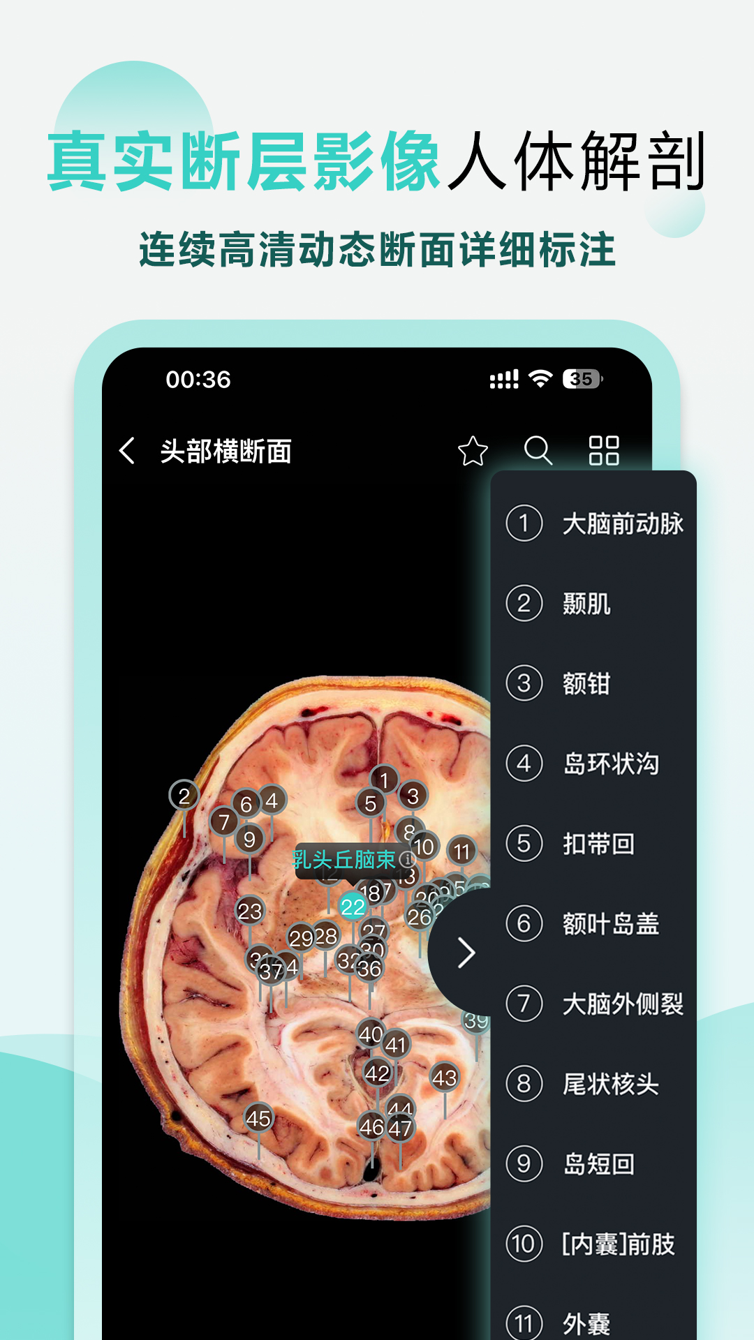 掌上3D解剖软件封面