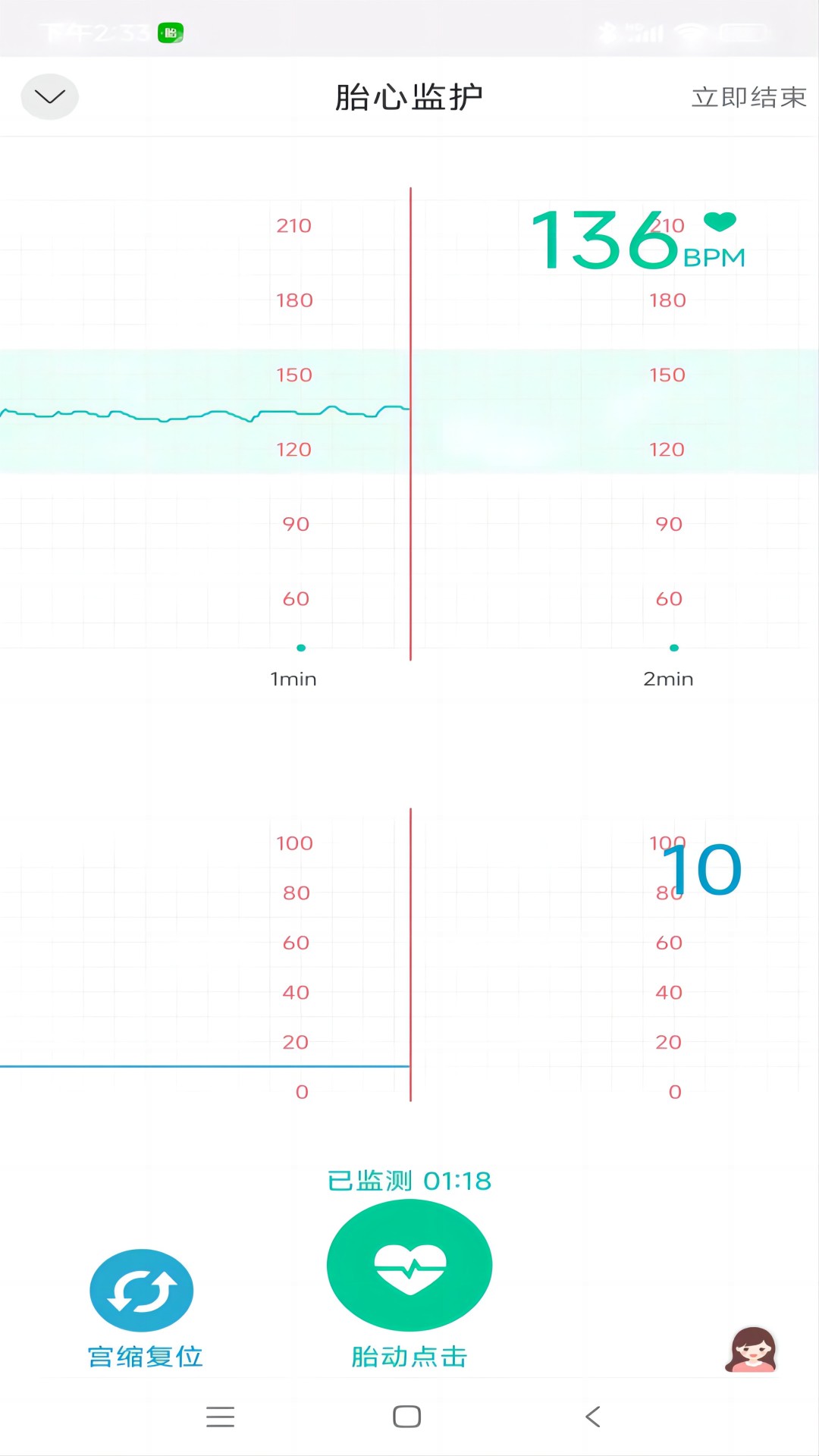 微胎心用户版软件封面